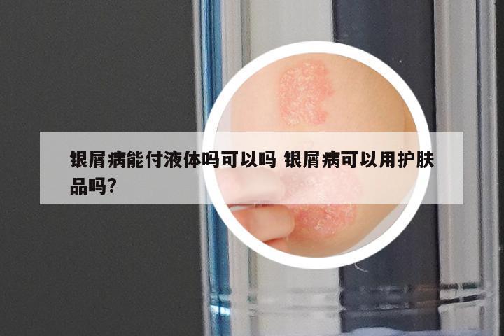 银屑病能付液体吗可以吗 银屑病可以用护肤品吗?