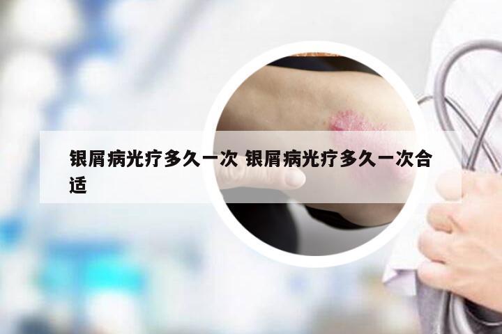 银屑病光疗多久一次 银屑病光疗多久一次合适