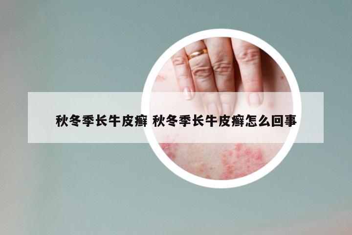 秋冬季长牛皮癣 秋冬季长牛皮癣怎么回事