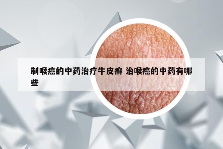 制喉癌的中药治疗牛皮癣 治喉癌的中药有哪些
