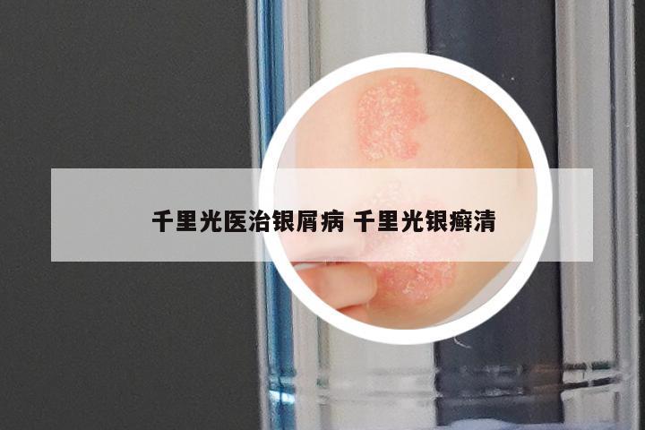 千里光医治银屑病 千里光银癣清