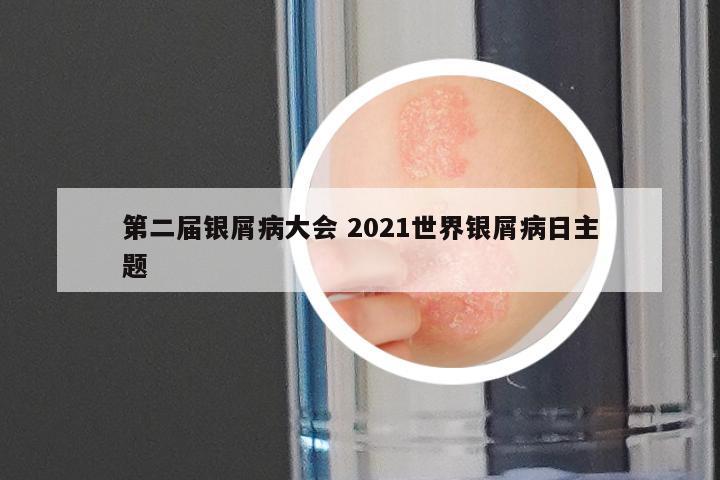 第二届银屑病大会 2021世界银屑病日主题