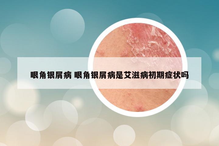 眼角银屑病 眼角银屑病是艾滋病初期症状吗