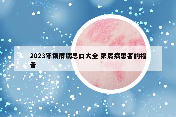 2023年银屑病忌口大全 银屑病患者的福音
