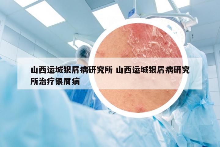 山西运城银屑病研究所 山西运城银屑病研究所治疗银屑病