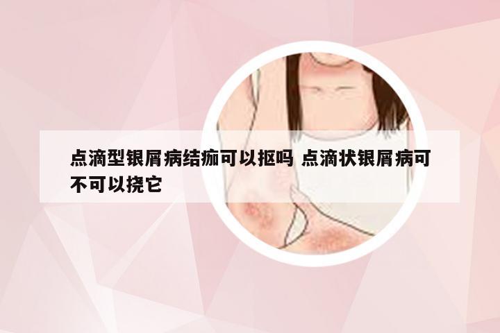 点滴型银屑病结痂可以抠吗 点滴状银屑病可不可以挠它
